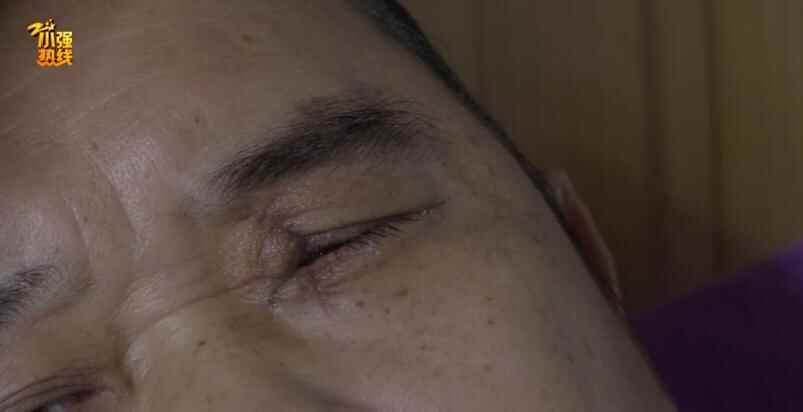 哈尔滨啤酒突然爆裂，男子眼球被炸破